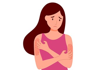alergia-al-condon